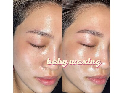 ベイビーワクシング(baby waxing)の写真