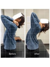 ナオル整体 浅草院(NAORU整体)/１０代女性【背骨の柔軟性】