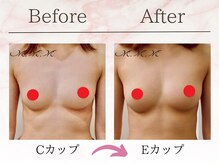 エムエムエム 表参道Luxeサロン(M.M.M)/【バストアップ例】　C→Eカップ