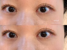 アノカプイル(ankpil)/【パリジェンヌラッシュリフト】