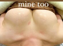 マイントゥー(mine too)