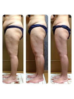 健康センター トロイカ/ダイエット成功実績、事例多数!