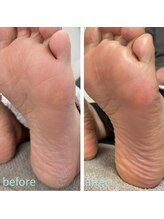 ミニーシュ(mini-che)/