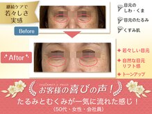 プレシャスワン 越谷店の雰囲気（越谷で美容鍼２００本で持続的なしわとたるみをスッキリ改善！）