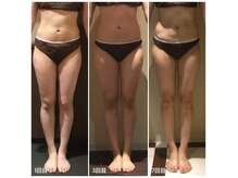 ユジュ(yju)の雰囲気（二の腕背中美人・脚長スラリ・美くびれ人気のオーダーメイド施術）