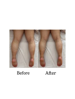 クリスタリオサーナエヌ 自由が丘(crystallo Sana N)/足が細くなるだけじゃない