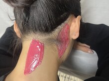 ミルダ(MIRUDA)の雰囲気（ブラジリアンワックス/光脱毛で自分に合った脱毛を。）