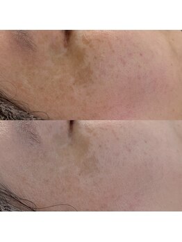 ヴェルシック(Belchic)/目の周りもしっかりとケアできる