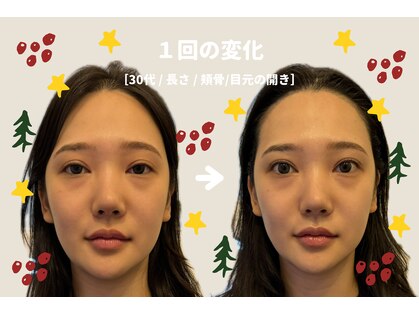 こつこつラボ サンイチマル オオル(310/OOL')の写真