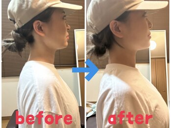 ワイズ パーソナル アンド ヘルス 恵比寿店(Y's Personal&Health)/筋膜リリースビフォーアフター