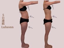 ヨサパーク デイジー(YOSA PARK Daisy)/痩身/よもぎ蒸し/ダイエット