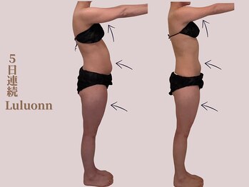 ヨサパーク デイジー(YOSA PARK Daisy)/痩身/よもぎ蒸し/ダイエット