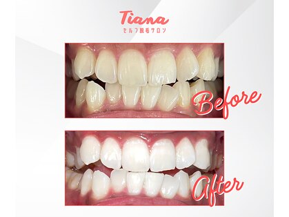 ティアナ 霧島店(Tiana)の写真
