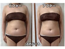 ぷれじーる/一度の施術から変わる