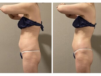 ラヴィエ ベル(La vie est belle)/上半身