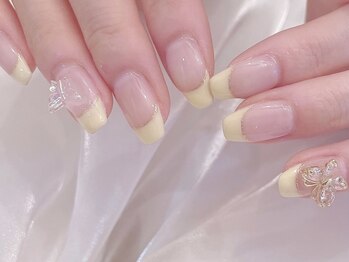 イエローフレンチ