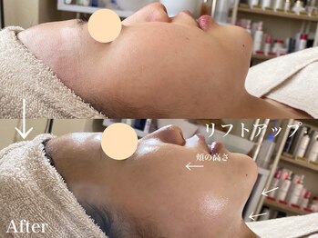 ドゥクス 難波店(Dux)/タラソでリフトUPも!?