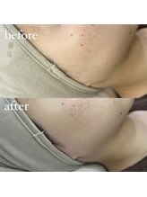 ミュゲ(muguet)/フェイスワックス