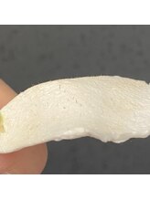 ボイスクレッシェンド(VOICE cresc.)/小鼻ワックス！