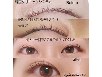 レア(lea)の写真