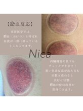 ニカ(Nica)/【お血反応】