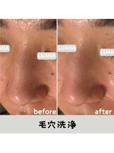 ルアナ 北谷店/毛穴洗浄毛穴ケア 《沖縄/北谷》