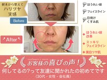 プレシャスワン 越谷店の雰囲気（くすみ肌、ほうれい線が気になる女性に最高の美容鍼若で々しさup）