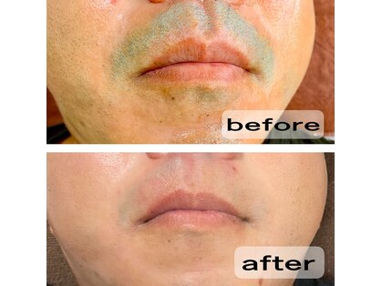 ヴェリテ(Verite)の写真