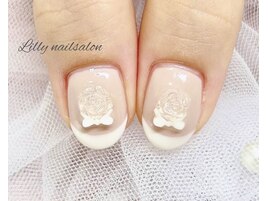 ガーリーフレンチ