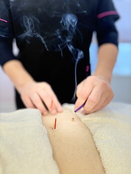 リッシュはり灸整体院/施術風景２