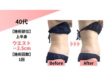 クレビア(Clevia)/Clevia-クレビア