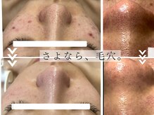 アクシア(Axia)