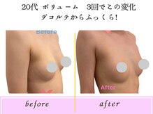 ビーハピネス 京都西院(B-Happiness)/10代ボリュームでお悩み