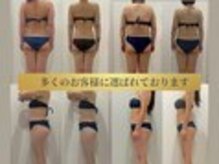 ヴィナーレ(VINARE)の雰囲気(名古屋市港区痩身/Instagramでは症例をアップしております)