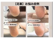 エム 平岸(M)の雰囲気（【足裏】かかとの乾燥/ひび割れ・タコ魚の目ケアもお任せ下さい）