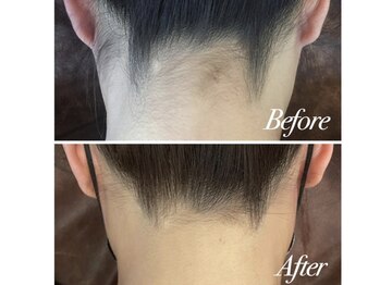 サロン ロワ(Salon Rowa)/最新で最高級の脱毛機器導入！