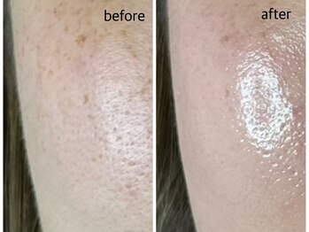 リジョーナ 一宮店(Lijona)/艶々もちもち肌質改善