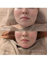 サロン ド モミカル(salon de momikaru)/