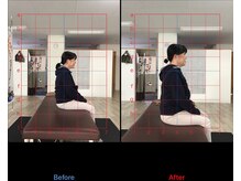 ストレチックス 近江八幡店/BeforeAfter