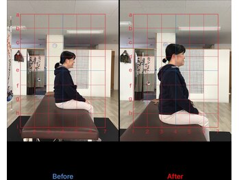 ストレチックス 近江八幡店/BeforeAfter