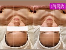 ラドゥサー(La douceur)/