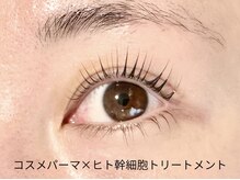 話題のマスカラパーマ+ヒト幹細胞トリートメントで自まつ毛ケア