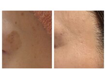 ミヤビ(MIYABI)の雰囲気（何をしても変わらなかった年齢肌のお悩みに寄り添います。）