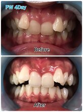 ドクターモック(Dr.MOC)/ＢＥＦＯＲＥ→ＡＦＴＥＲ