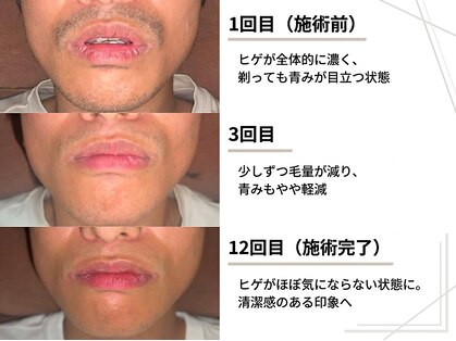 オーシャンズ 赤坂店(OCEANS)の写真