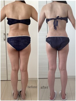 サロンドルフレ(salon de Reflet)の写真/【春に向けて!徹底的に痩せさせる本格痩身】“神技オールハンド”で溜まったお肉を徹底撃退!