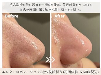 ミエル 神戸店(Miel)の写真/毛穴洗浄だけで満足？その後の導入ケアで肌は変わる。肌内部にまで美容成分をたっぷり導入し潤い溢れる肌へ