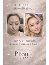ビジュー(美柔 Bijou)&nbsp;【美肌への 想い】