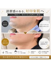 ケープラス(K Plus+)