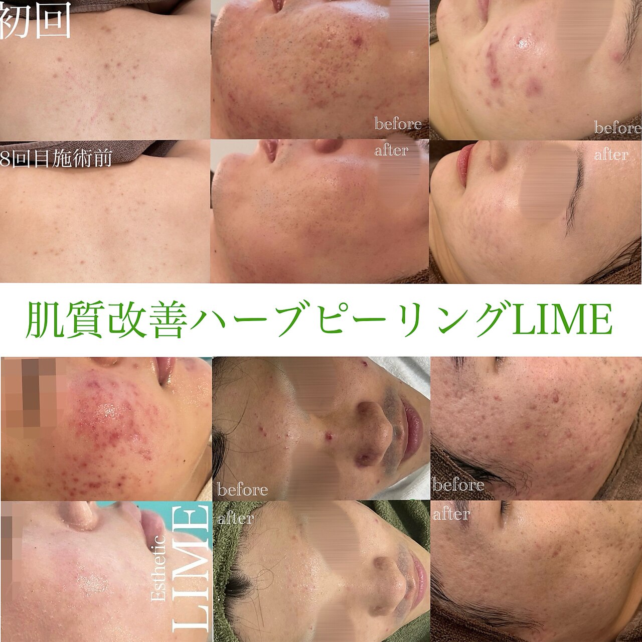 ライム 錦糸町(LIME)｜ホットペッパービューティー